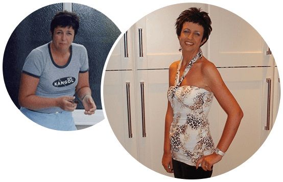 Sharon-Briers-zotrim-before-after-picture