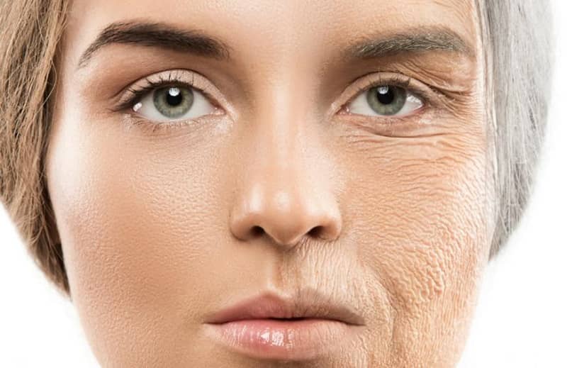 Causes of Anti Aging