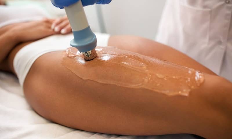 Medical Treatment for Cellulite